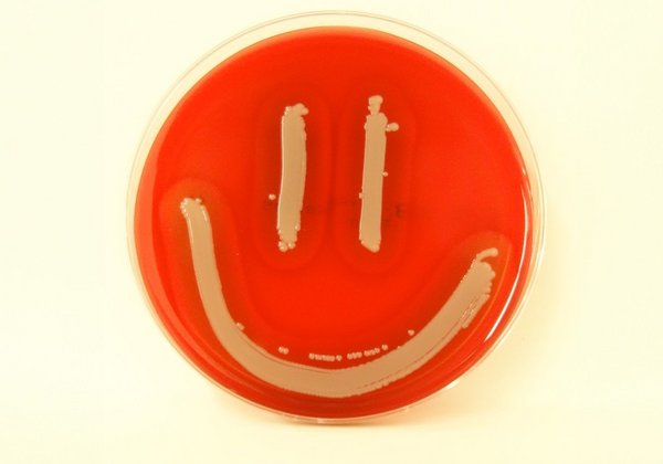 Blutagarplatte mit Bakterienausstrich in Smiley-Form